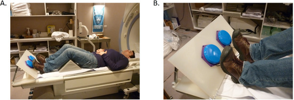 figure-protocol-2 MRI static equilibrium positioning with foam wedges, diagram of patient setup for minimizing motion.