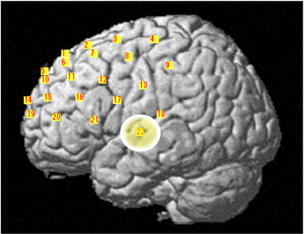figure-protocol-6 Labeled brain diagram, highlighting regions for neuroscientific study and cognitive function mapping.