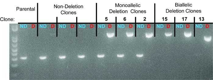 figure-results-3 Agarose gel electrophoresis results, DNA clone deletion analysis, highlighting monoallelic, biallelic mutations.