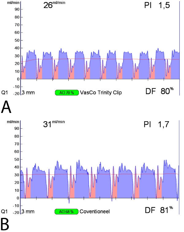figure-results-6 Flow rate analysis graphs showing VasCo Trinity Clip and Coventioneel, data visualization comparison.