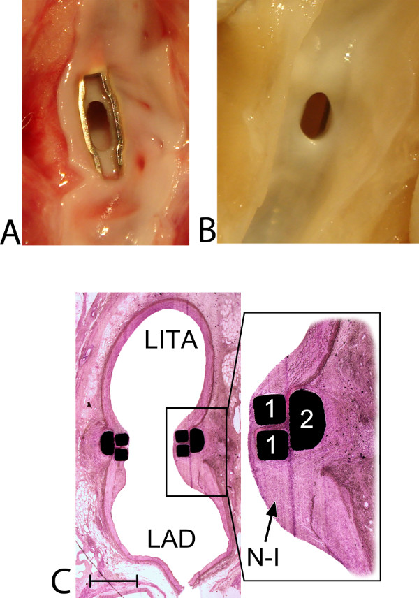 figure-results-8 Stent graft integration, histological analysis, cross-section diagram, vascular structure.