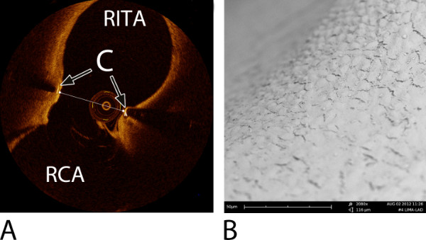 figure-results-9 Coronary optical coherence tomography and microscopic tissue examination, cardiac structure analysis.