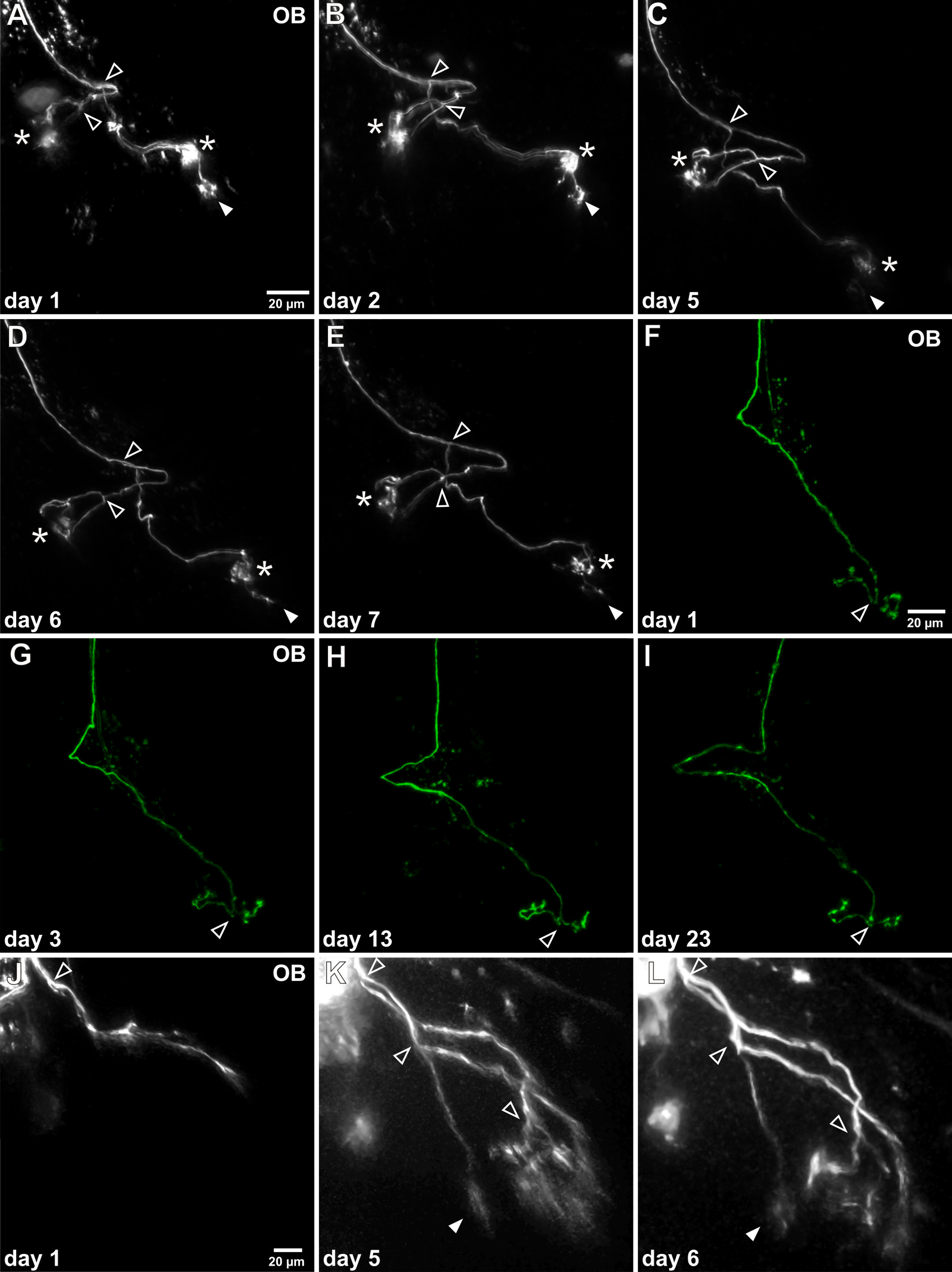 figure-results-4 Static equilibrium microscopy images showing neuron time-lapse; fluorescence; days 1-23 observation.