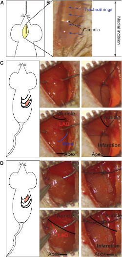 figure-results-1 Mouse heart surgery illustrations; diagrams showing incision and infarction in LAD research.