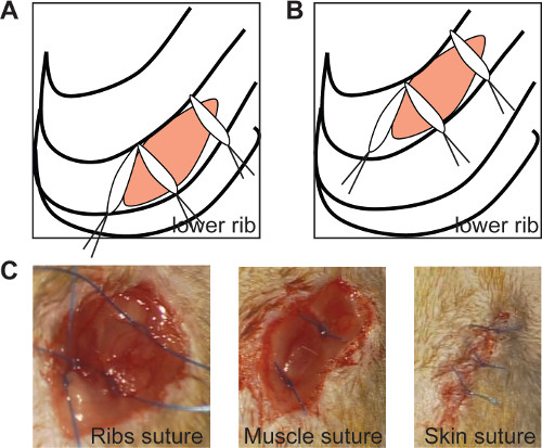 figure-results-2 Surgical suture diagrams A, B and images C of rib, muscle, skin sutures for medical study.