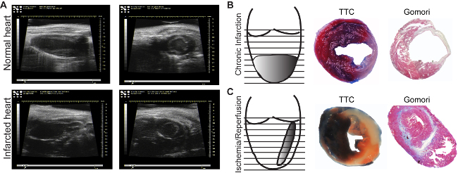 figure-results-3 Normal vs. infarcted heart ultrasound; diagram of chronic infarction, ischemia/reperfusion, TTC, Gomori staining results.