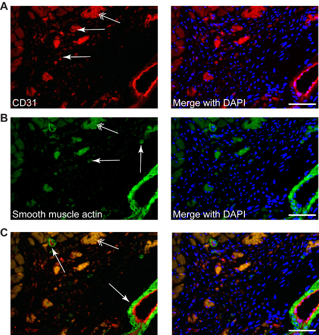 figure-results-4 Immunofluorescence microscopy images showing CD31 and smooth muscle actin with DAPI merging.