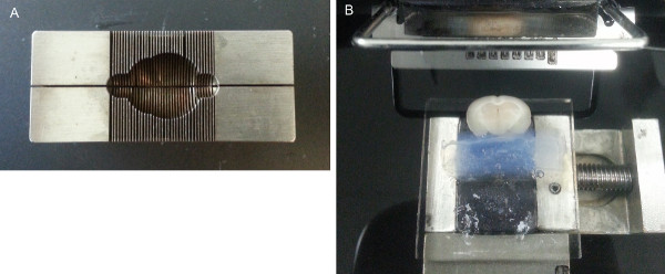 Metal mold setup for brain specimen embedding and sectioning; histological preparation technique.