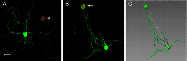 Microscopy image of neuronal cell structures; green fluorescence, axon guidance, 3D analysis diagram.