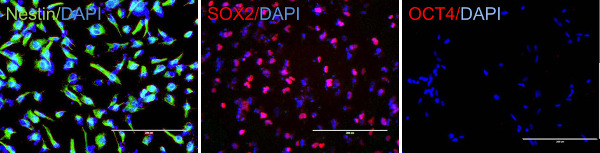 Immunofluorescence microscopy of Nestin, SOX2, OCT4, DAPI-stained cells; protein expression analysis.