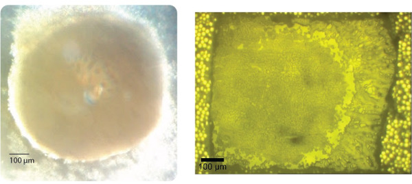 Microbial growth microscope images; left: bacteria colony, right: fungal spore structure, 100 μm scale.