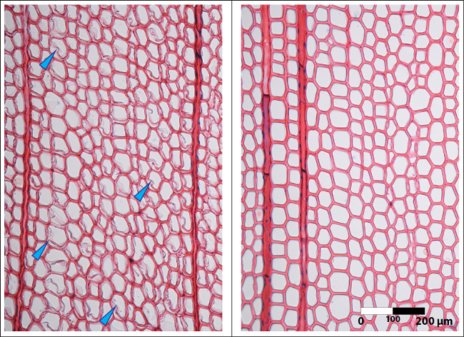 Plant cell structure comparison, microscope image, highlighting xylem and phloem components.