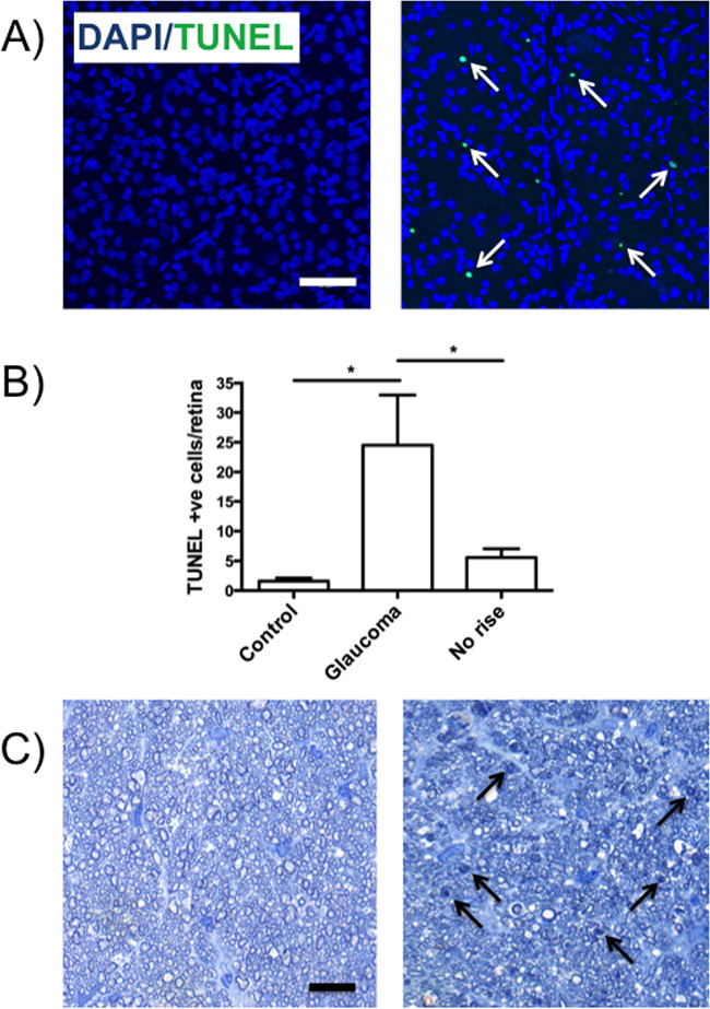 figure-results-2 DAPI/TUNEL apoptosis assay: fluorescence images (A), bar chart (B), retina sections (C).