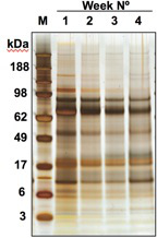 figure-results-3 SDS-PAGE electrophoresis results, protein separation with molecular weight markers, data analysis.