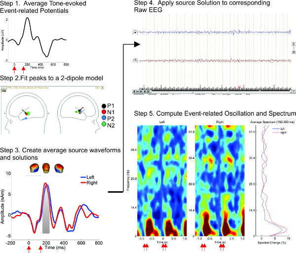figure-results-1 Event-related potential analysis; EEG data processing; dipole modeling; waveform solutions; spectral analysis diagram.