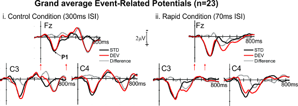 figure-results-2 Grand average event-related potentials graph; control vs rapid condition; EEG data analysis.