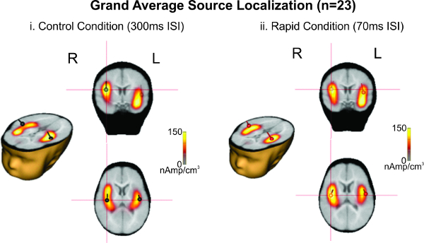 figure-results-3 Brain source localization diagram, control vs. rapid condition, nAmp/cm³ heatmap comparison.