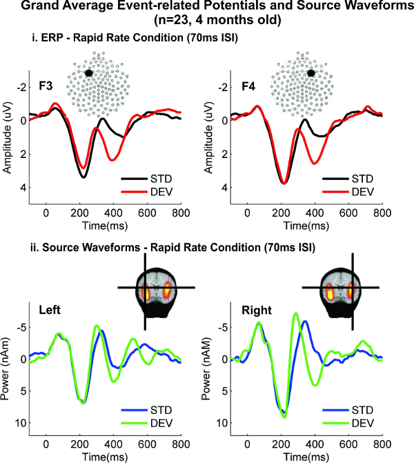 figure-results-4 ERP source waveforms, rapid rate, 70ms ISI; diagrams and graphs show amplitude, power dynamics.