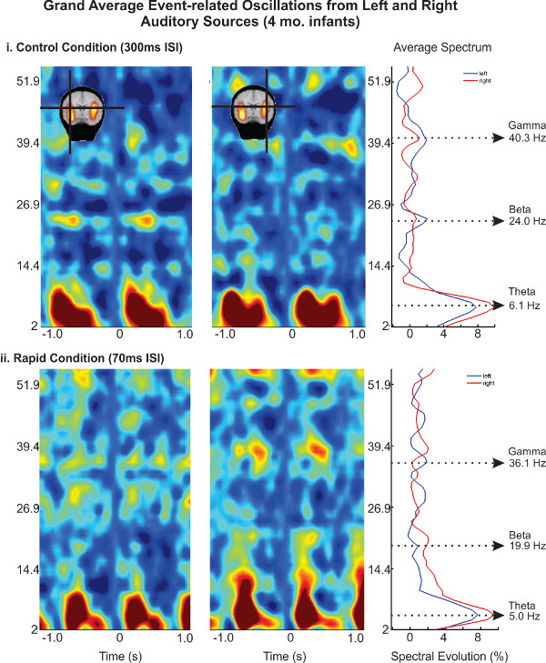 figure-results-5 Event-related oscillations in infants: heat maps, spectral evolution, auditory brain analysis.