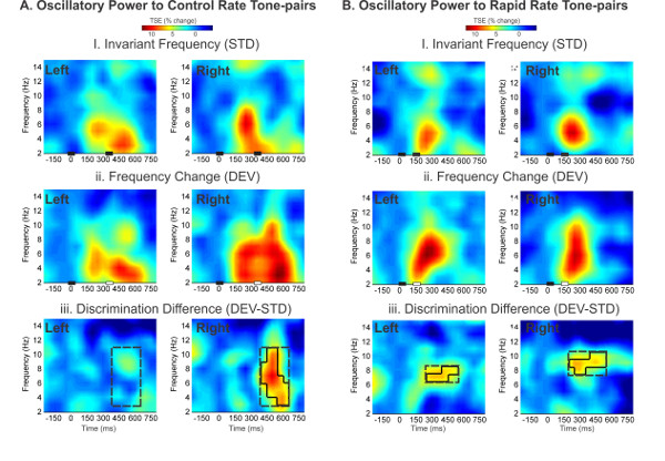 figure-results-6 Oscillatory power comparison diagram shows tone-pair frequency changes and discrimination analysis.
