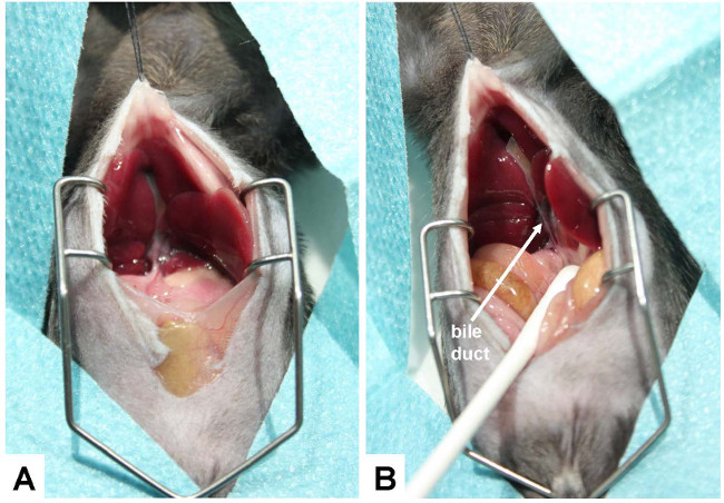 Surgical technique diagram showing mouse bile duct exploration with retractor and probe for study.