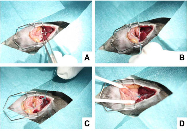Surgical procedure diagram; involves suturing technique in a clinical experimental setup.