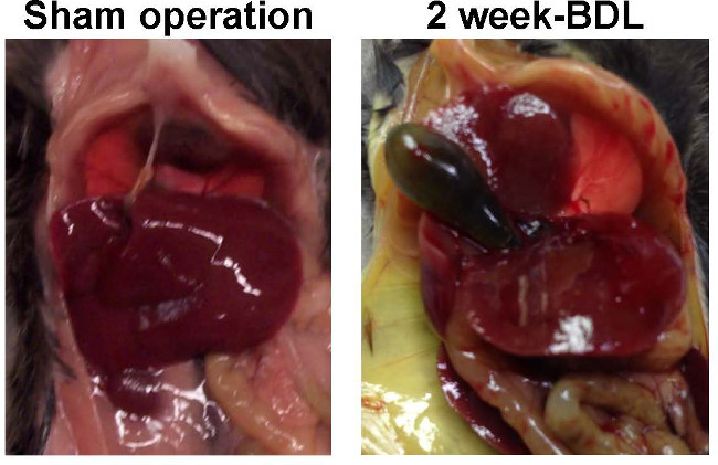 Liver health comparison diagram; sham vs 2-week bile duct ligation results in animal model.