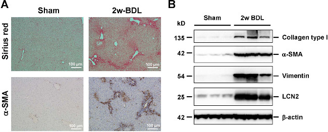 Histology, Western blot analysis; Sirius red, α-SMA staining; liver fibrosis, protein expression results.