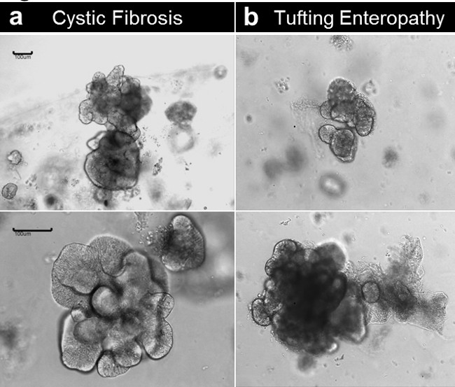figure-results-6 Cystic Fibrosis, Tufting Enteropathy tissues in microscope image, cellular structure comparison.