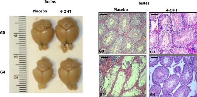 figure-results-2 Brain growth comparison; placebo vs 4-OHT. Histology: testes, G0-G4.