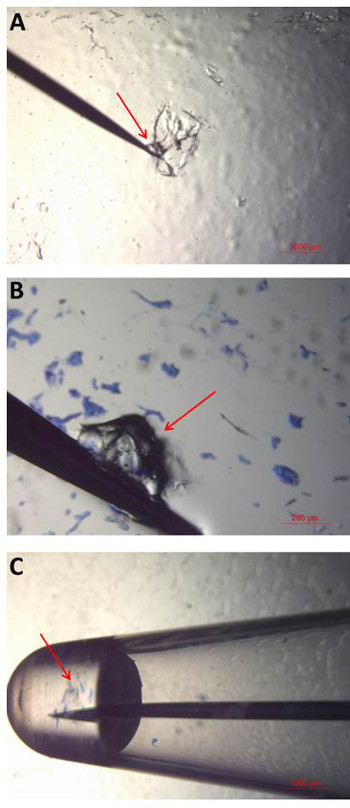 Microscopy images of microlaser integration process, illustrating fine-detail assembly at microscopic scale.