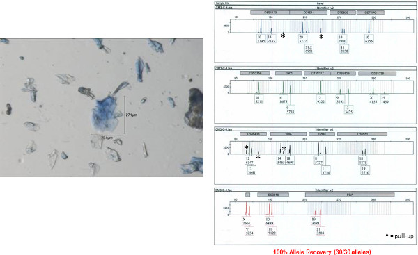 Microscope image of microplastic particles; DNA sequencing results, allele recovery analysis, 100%.
