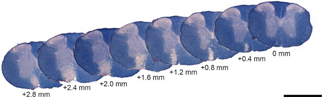 Brain slice series diagram showing progressive sections with millimeter scale labels.