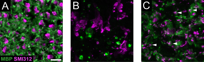 MBP SMI312 fluorescence microscopy images showing neural tissue staining patterns in green and magenta.