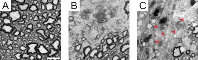 Microscopy image illustrating cellular structure variation, highlighting membrane differences, experiment.