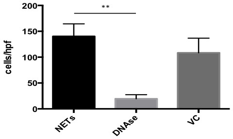 Bar chart comparing cell counts; NETs, DNAse, VC; indicating statistical significance.