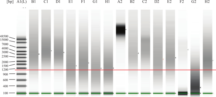 Electrophoresis result diagram shows DNA separation by size for genomic analysis and band quantification.