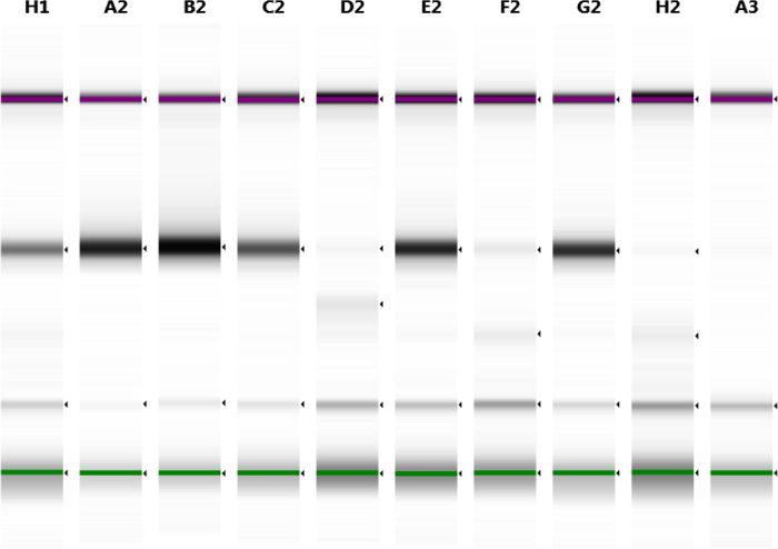 Electrophoresis gel diagram, DNA separation results, protein bands, molecular analysis.