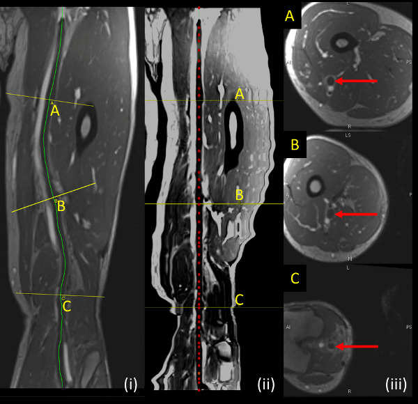 Przekroje rezonansu magnetycznego; diagram analizy anatomicznej; Widoki strzałkowe, czołowe, osiowe z etykietami.