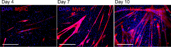 figure-results-10 Immunofluorescence showing DAPI-stained nuclei and MyHC in muscle cells over 10 days.