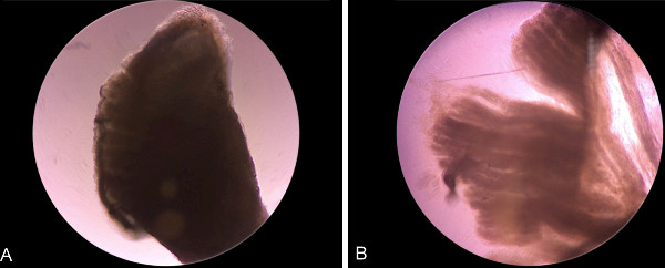 figure-results-5 Microscopic image of tissue sections A and B; comparative cellular structure analysis.