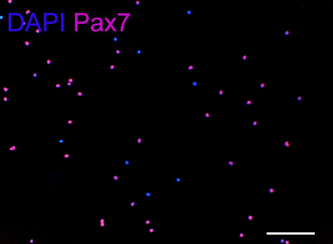 figure-results-6 Fluorescence microscopy image of DAPI and Pax7 stained cells, showing nuclear and protein localization.