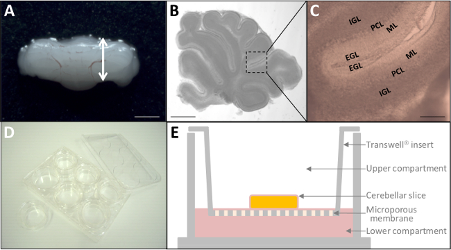 figure-results-2 Cerebellar slice culture preparation; anatomy labeled; Transwell system diagram; microscopy images.