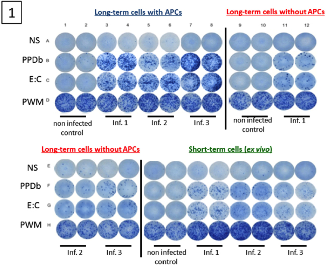 Cell cultures stained in a microscopy experiment, comparing infection effects in long/short-term cells.