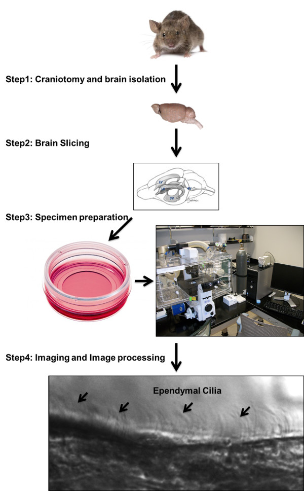 figure-results-1 Mouse brain dissection, imaging process diagram: craniotomy, slicing, specimen prep, cilia analysis.