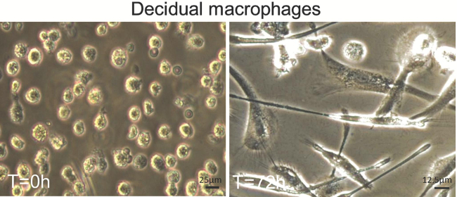 Decidual macrophages microscope images, cellular structure, time-lapse comparison at 0h and 72h.