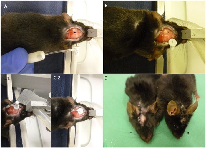 Mouse cranial procedure, stereotactic injection, skull opening, and post-surgery recovery stages.