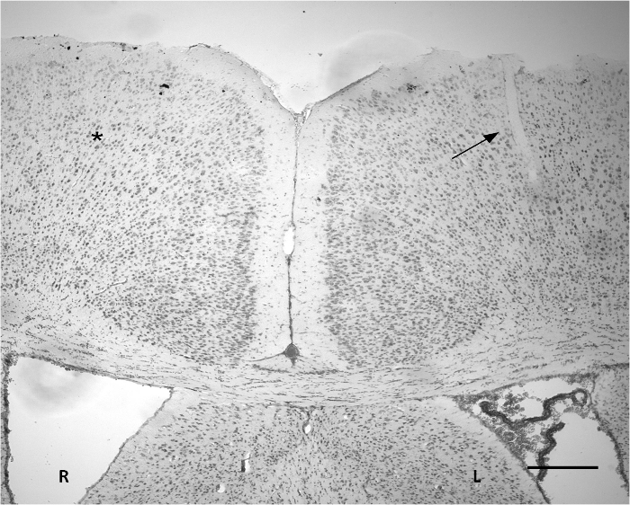 Histology slide; spinal cord transverse section; tissue morphology; neural cell distribution; microscope.