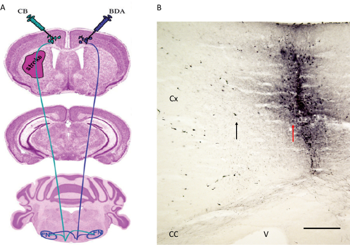 Neuroanatomy diagram and microscopy image showing rat brain tract tracing and neural pathways.
