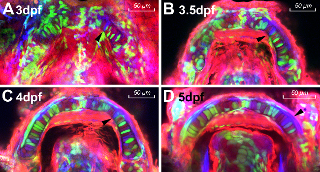 Developmental stages of zebrafish at 3-5 dpf, fluorescence microscopy, highlighting cellular growth.